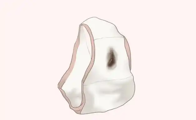 为什么月经来完后会有褐色分泌物流出?一切都要从我们的"底下"说起.