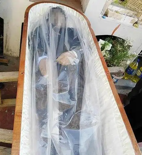 内细胞将因缺氧而在数分钟后死亡,所以,,人体通常在死后数天开始腐烂