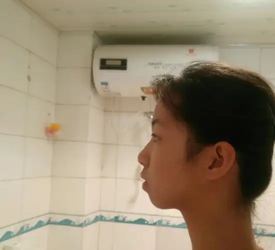 侧脸不好看怎么办