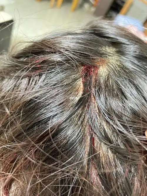 真不愧是亚洲最大哥斯拉 直接头被砸出血_godzilla(哥斯拉)电音剧场