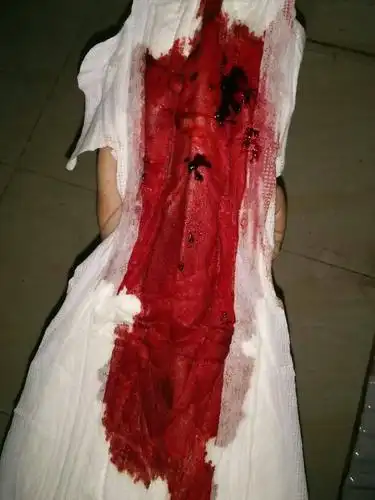 请问我这个月经是什么颜色