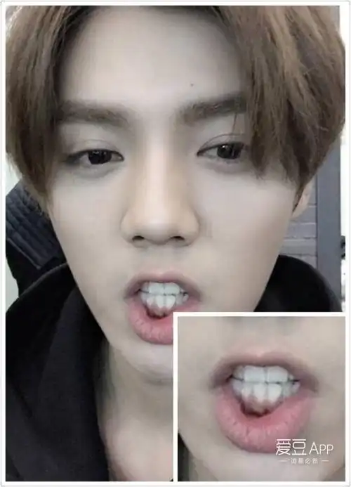 [鹿晗][盘点]161106 不整齐也是一种美,鹿晗的下牙是实力萌呀