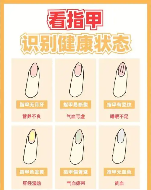 看指甲识别健康状态