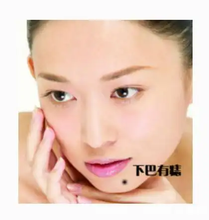 身上的10个招财好痣,有一个就发大财了