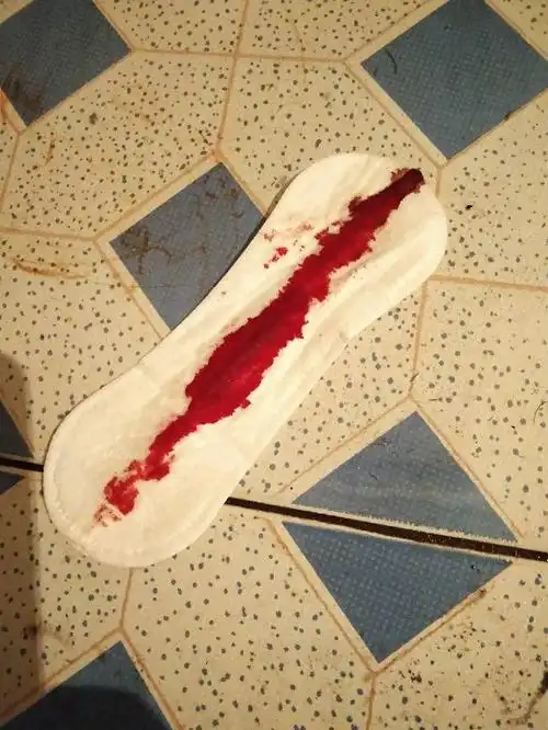 啥10号中午买的金毓婷吃了之后16号流了一整天血我不知道是来大姨妈还