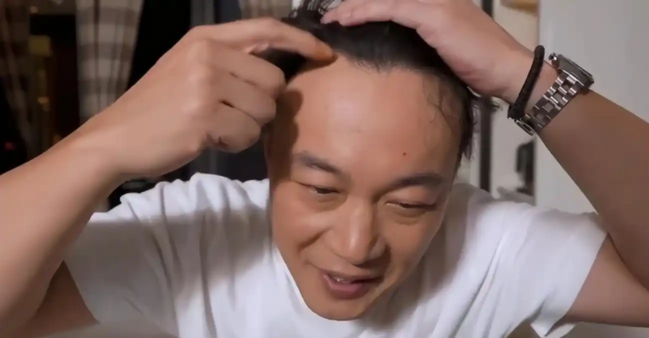 长得很英俊但头发却掉得厉害!沙溢,彭于晏,白敬亭一脸和无奈