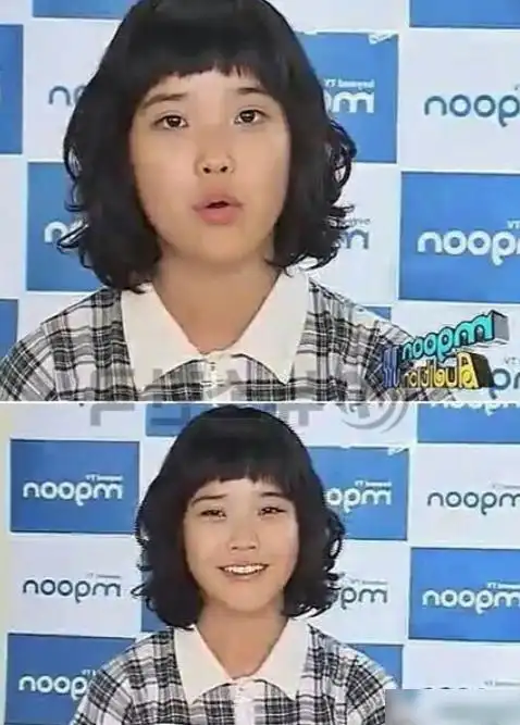 疑似iu整容前照片曝光看清以前模样后能把医生电话给我吗