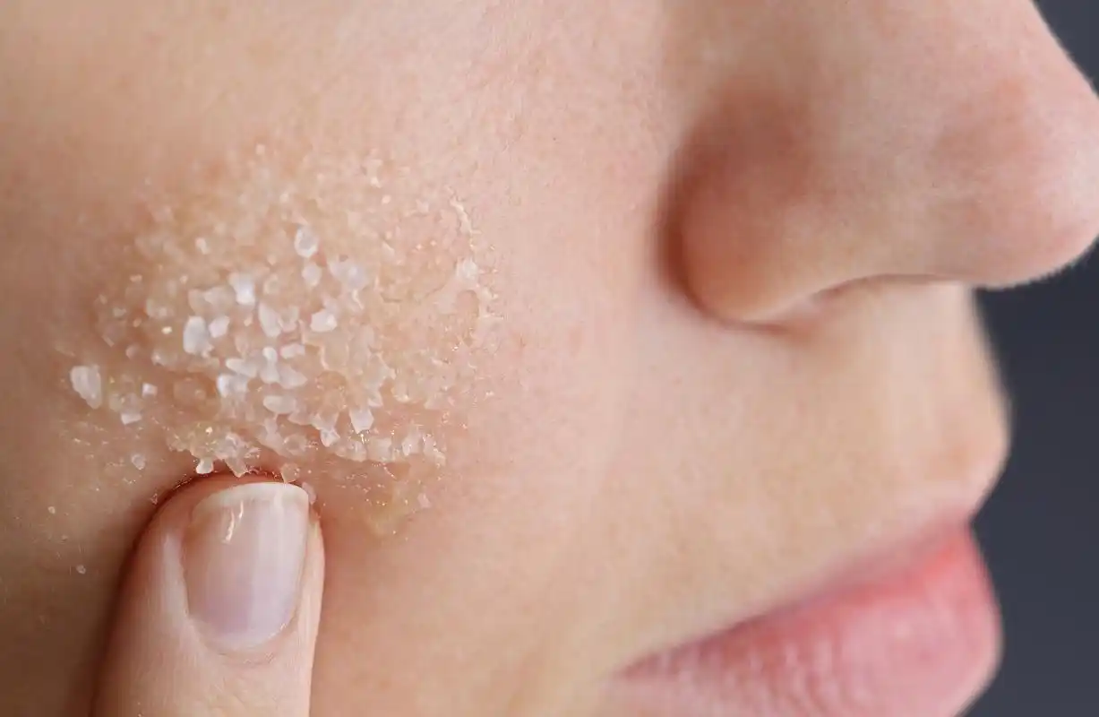 脸部干燥起皮怎么办?分享8个应对脸部干燥起皮的方法!