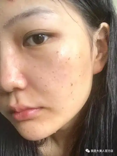 比一般的啫喱状要水润些, 无任何颗粒感,放在皮肤上揉搓,很快就水化了