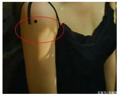 手臂有痣好吗?不同位置的痣代表什么?看完你就懂了