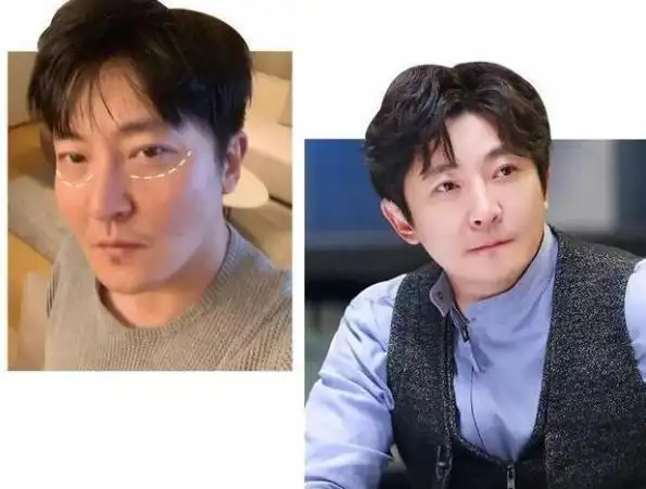 郭京飞割完眼袋形象大变,与之前相比判若两人,网友:精致老boy