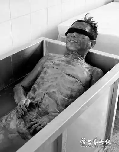 福尔马林(福尔马林浸泡的人体标本)