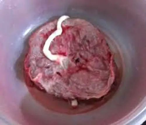 人胎盘详细的特征图片