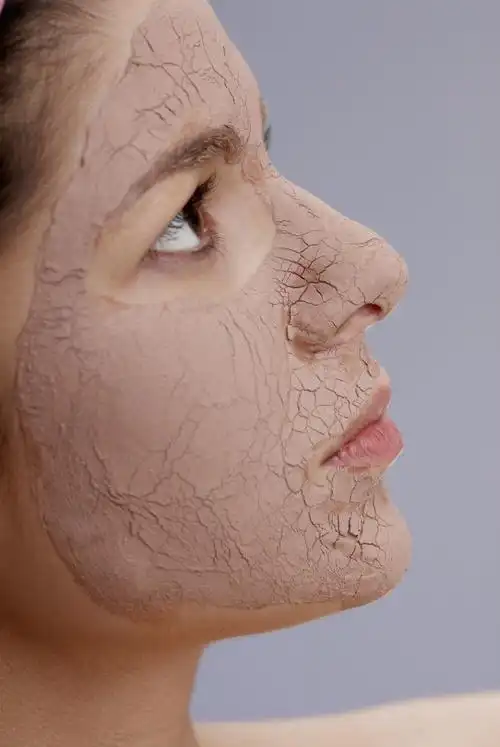 皮肤特别干燥缺水怎么办?