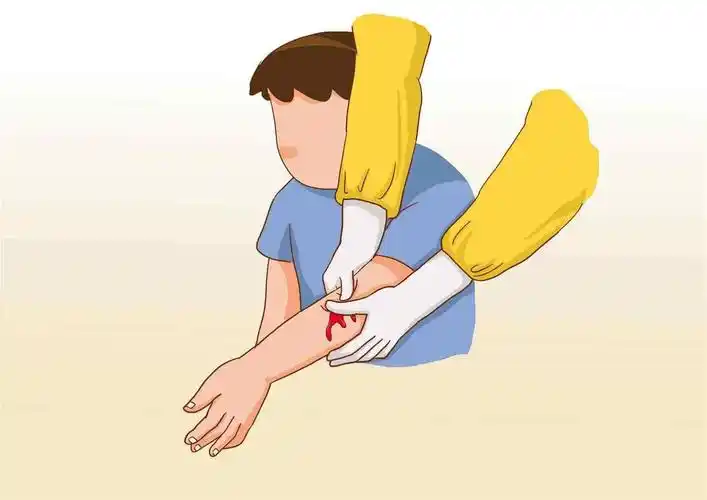 六大症状表示你的伤口会形成疤痕