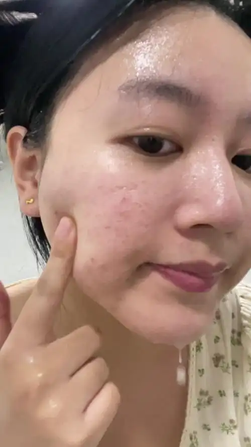 大油皮精简护肤