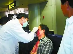 一乘客头部受伤血流不止