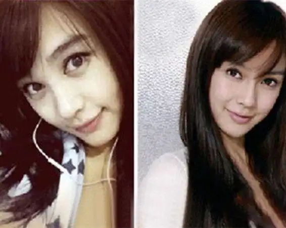 李菲儿整容前后照片曝光引出裙子滑落 被疑是为爱整容