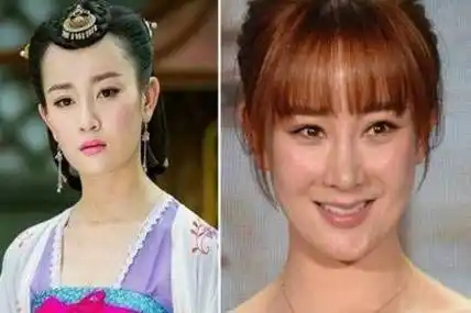整形失败的女明星都有谁