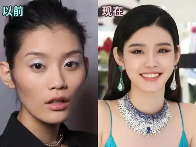 嫁入豪门3年奚梦瑶的脸怎么变这样了