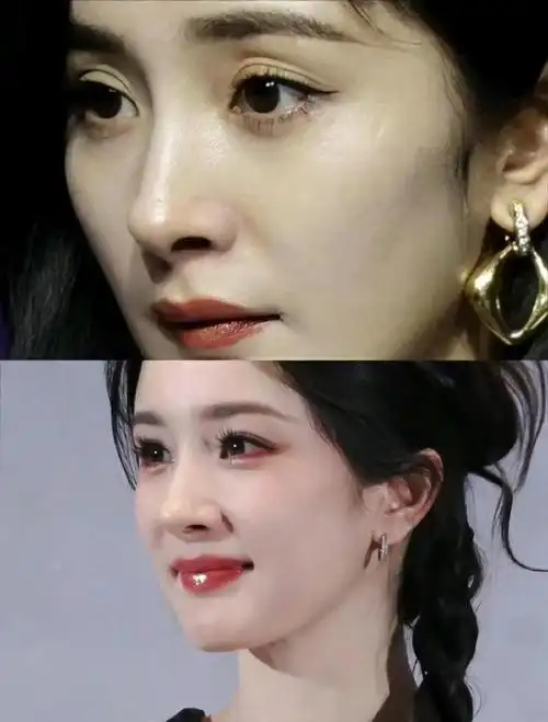 不得不说,杨幂面部抗衰这块