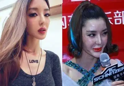 白领花14万赴韩整容反毁容盘点整容失败的十大明星