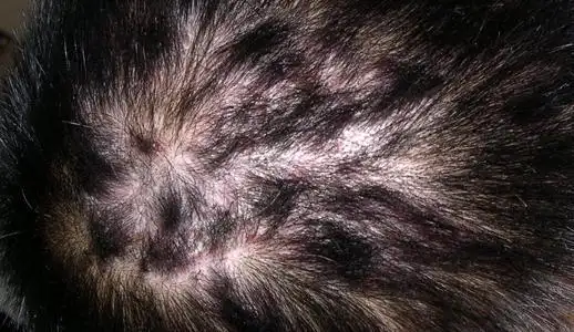 然而头皮却是我们最容易忽视的一个部位,人体的头皮其实是比较敏感的