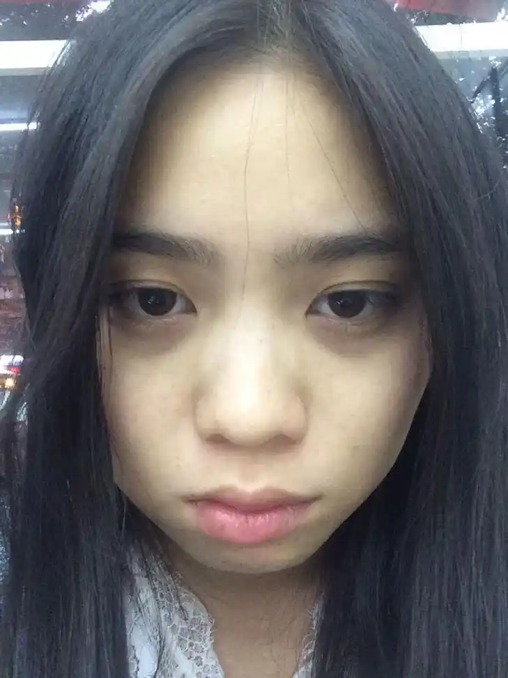 如何去除黑眼圈,长期12点睡觉,工作,没办法