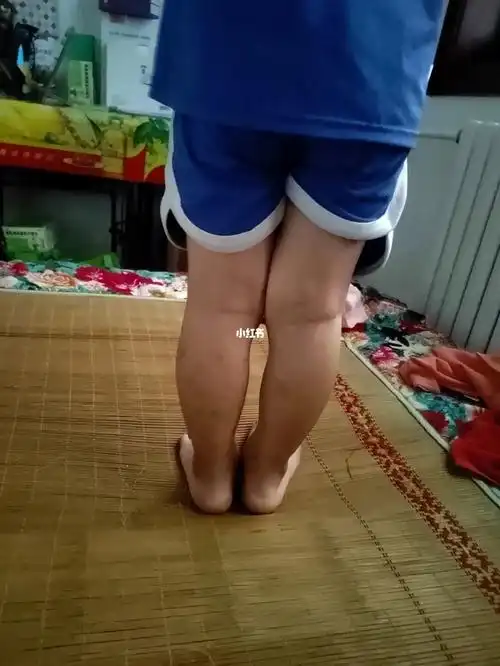 三岁半孩子躺床上我看着总感觉小腿外翻,不知道这样的腿型正常吗