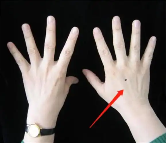 女人手背有个富痣图相 生近官近利 - 匠子生活