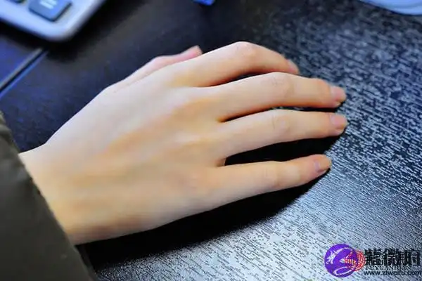 女人右手背有痣图解 右手背痣含义