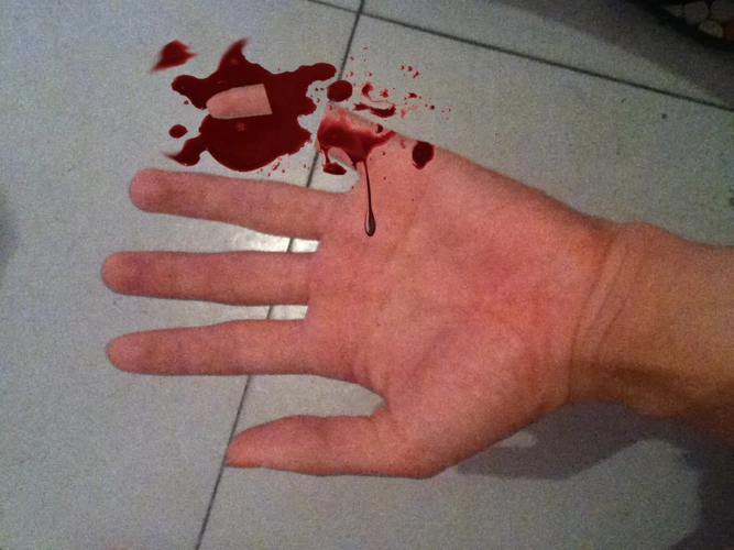 求ps大神帮我p成小指头砍下来的图片,下面都是血的,最好小指头在底下.