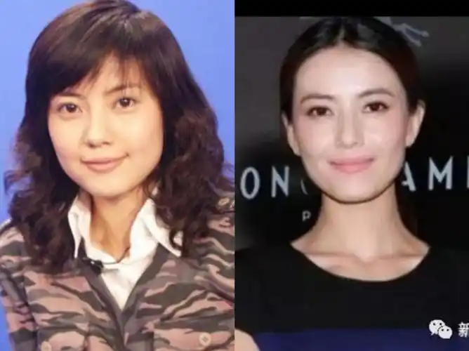 关于上一篇高圆圆整容的进一步分析