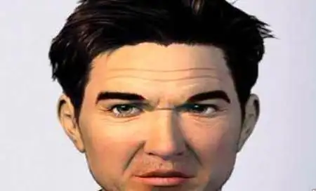 鼻子山根有横纹图片鼻子山根上有横纹