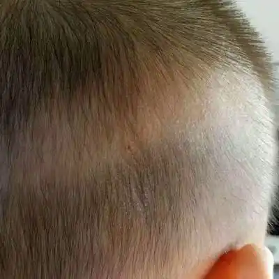 问答 婴儿期0-1岁 宝宝愿你健康平安的哦8个月6天2017-02-12 推荐回答