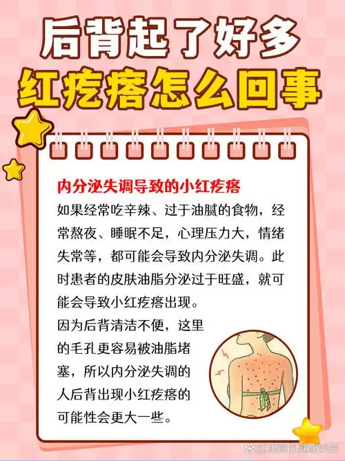 生活习惯不好,不注意个人卫生导致内分泌失调,后背长痤疮,患有毛囊炎