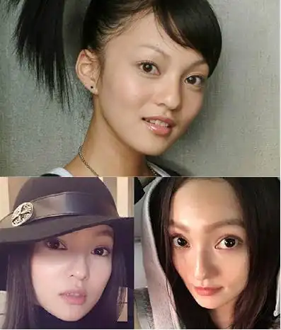 张韶涵近照曝光 整容后一天一个样