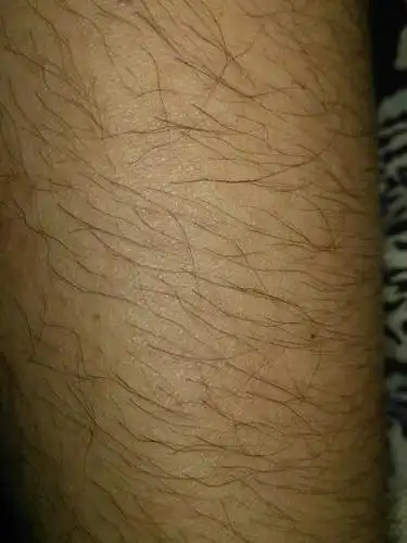 18岁男生还是学生平常喜欢吃蔬菜水果为啥我手上长这么多汗毛?