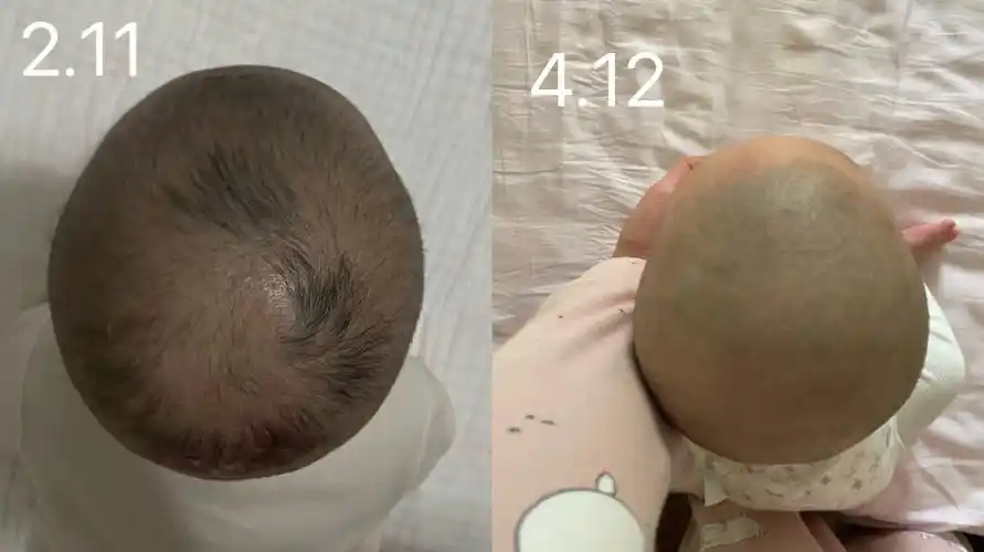 睡头型  #婴儿头型到底怎么睡  #如何睡出小圆头