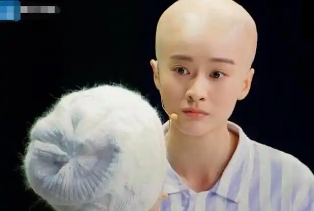 秃顶现在是没有办法去做发型的,秃顶只有将两边的头发留长遮盖中间