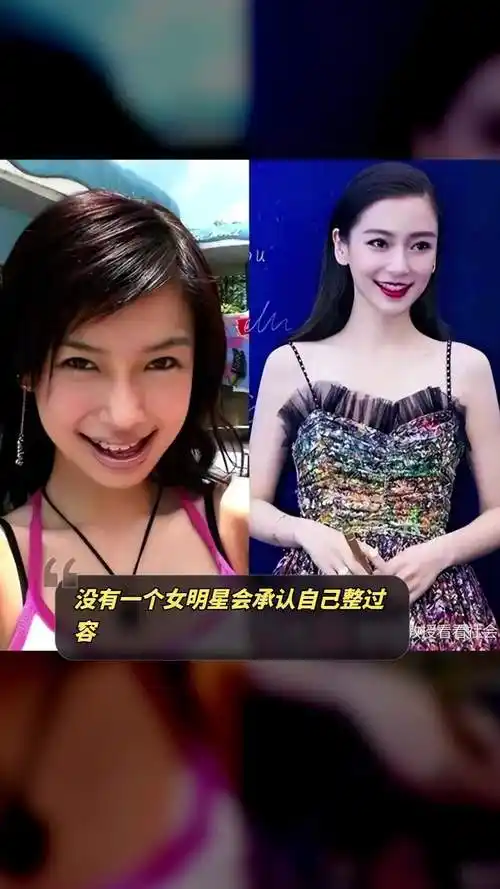 没有一个女明星会承认自己整过容「左捂脸」「左捂脸」「左捂脸」