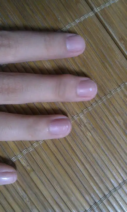 为何我的指甲上有这些小白点.我感觉好恐怖,谁能告诉我!qaq