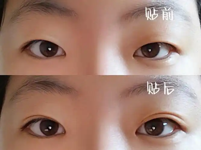 单眼皮手残党福音吃下这份双眼皮贴安利