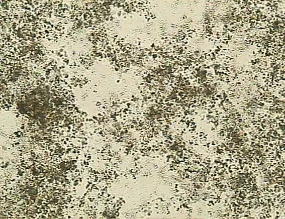 【求助】尿沉渣的各种结晶的图片