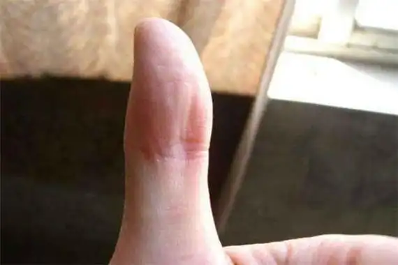 有凤眼纹的女人命苦吗 不会,凤眼纹是吉祥的征兆