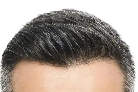 白头发染了会越来越多吗 白头发染黑能维持多久