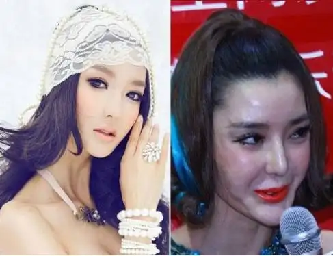 巩新亮领衔整容失败堪比毁容的十大明星