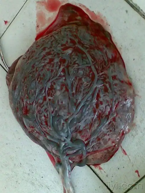 胎盘能不能吃,真的大补吗?_网易订阅