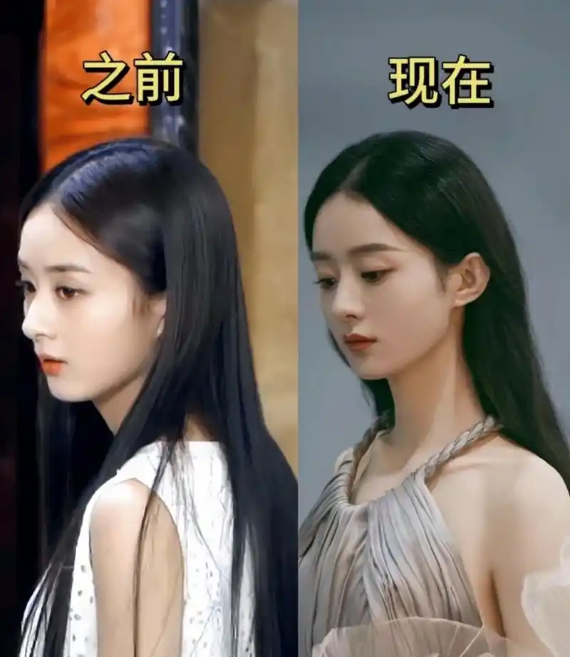 赵丽颖现昔对比:重返青春的秘籍揭晓,竟然如此神奇!