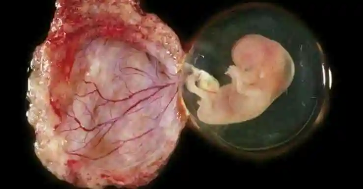 胎盘前壁怀孕觉得累的原因是什么